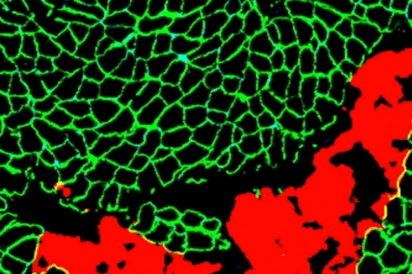 hydrogel injection into skeletal muscle