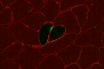 immunohistochemistry of muscle fibers in the shape of a heart